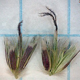 Close Microscopic View of Two Fascicles